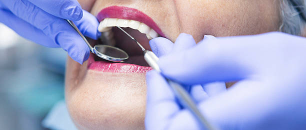 Best Emergency Root Canal Treatment in Cottonport, LA